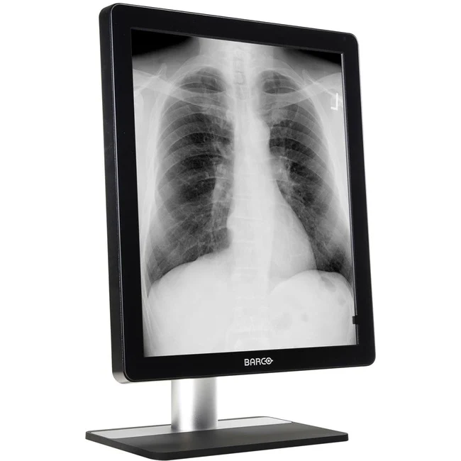 Barco Coronis MDCG-5221 21" Class LCD Monitor - 5:4 - Black - 21.3" Viewable - In-plane Switching (IPS) Technology - LED Backlight - 1200 Nit Maximum, DICOM Calibrated - 12.50 ms - DVI - DisplayPort