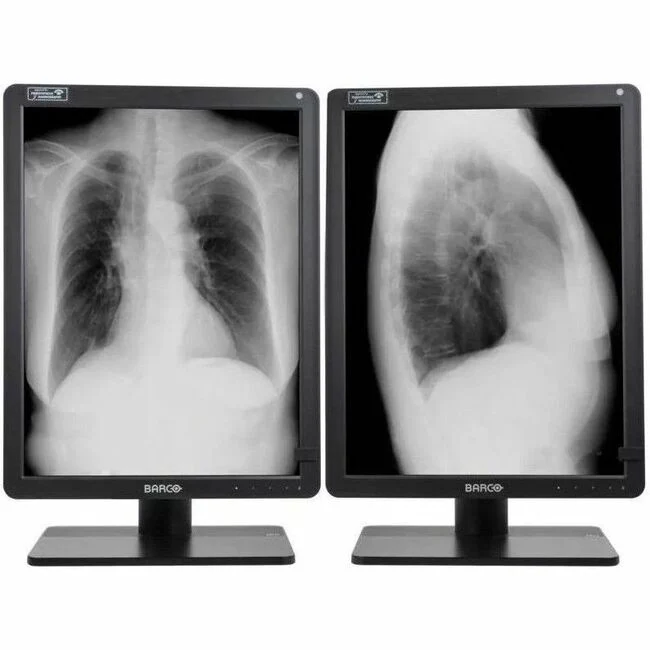 Barco Nio Gray MDNG-6221 21" Class QSXGA+ LED Monitor - 3:2 - Black - 21.3" Viewable - LED Backlight - 2100 x 2800 - 1024 Gray Levels - 1300 Nit - 12.50 ms - DVI - HDMI - DisplayPort - USB Hub