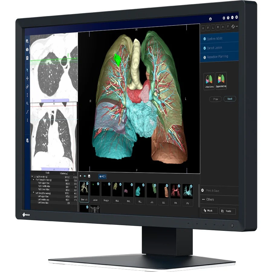 EIZO RadiForce MX243W 24" Class WUXGA LCD Monitor - 16:10 - Black - 24.1" Viewable - In-plane Switching (IPS) Technology - LED Backlight - 1920 x 1200 - 1.07 Billion Colors - 410 cd/m² - 22 ms - DVI - DisplayPort - USB Hub