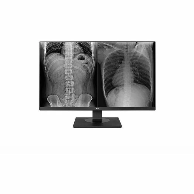LG 27HJ713C-B 27" Class 4K UHD LCD Monitor - White - 27" Viewable - LED Backlight - 3840 x 2160 - HDMI - DisplayPort